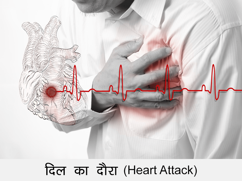 Heart Attack in Hindi