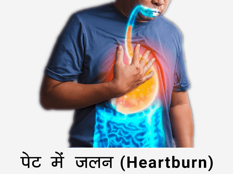 Heartburn in Hindi