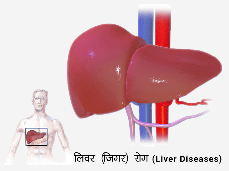 Liver Diseases in hindi